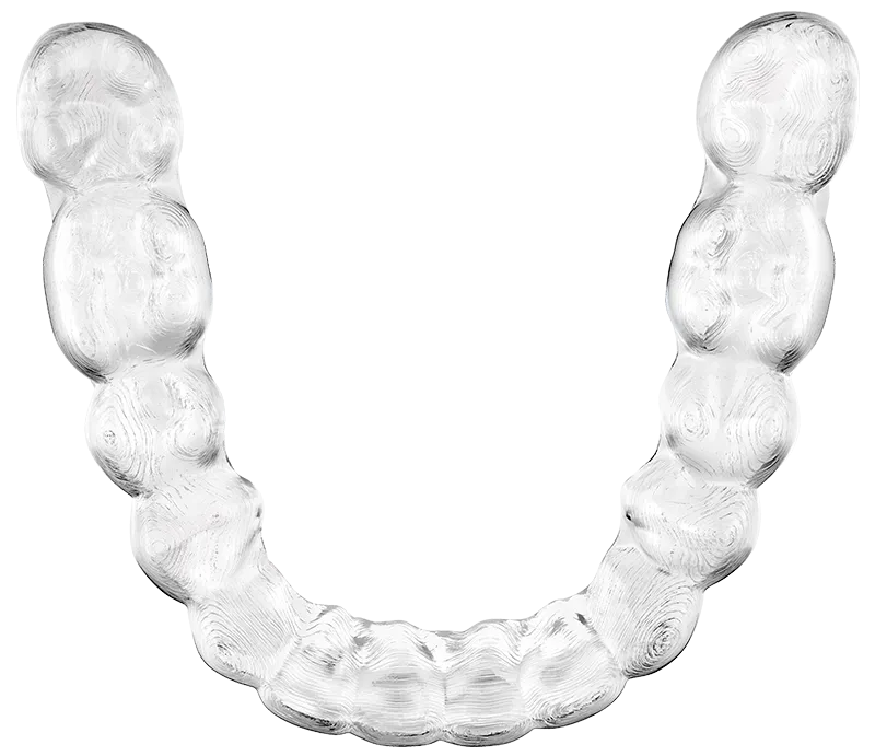 Spark clear aligner