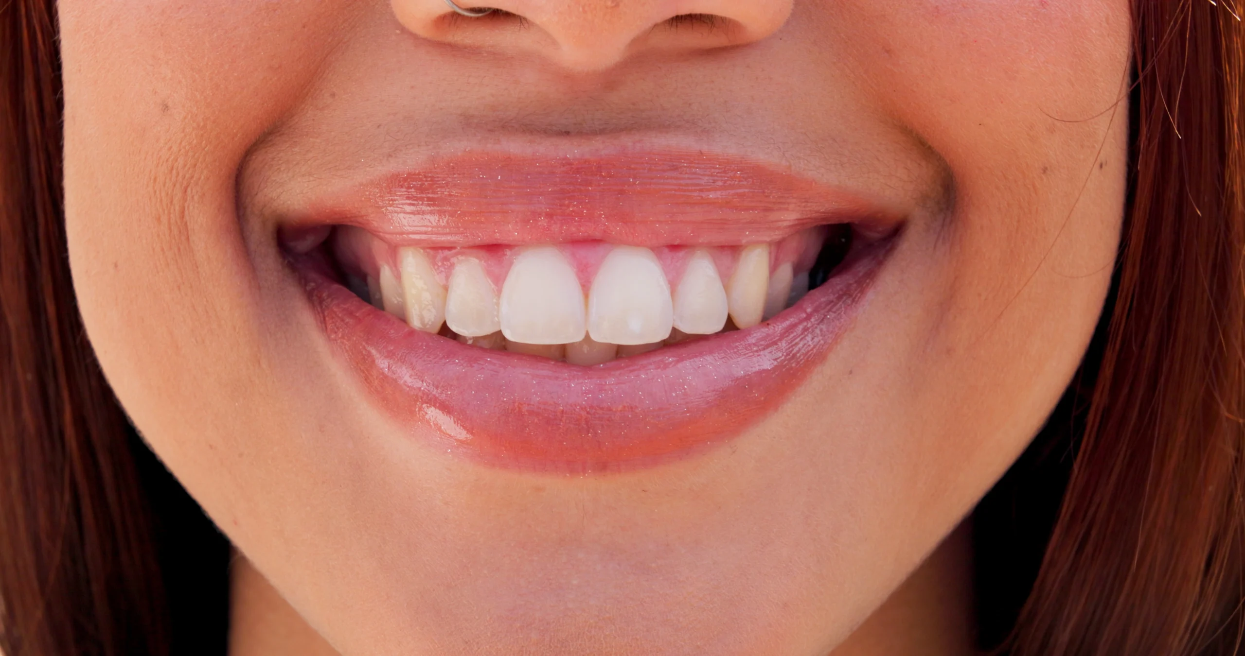 Gum Treatment