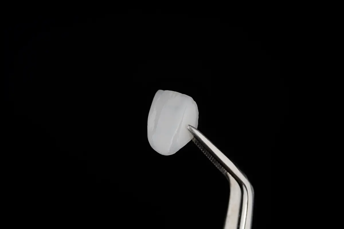 Veneers
