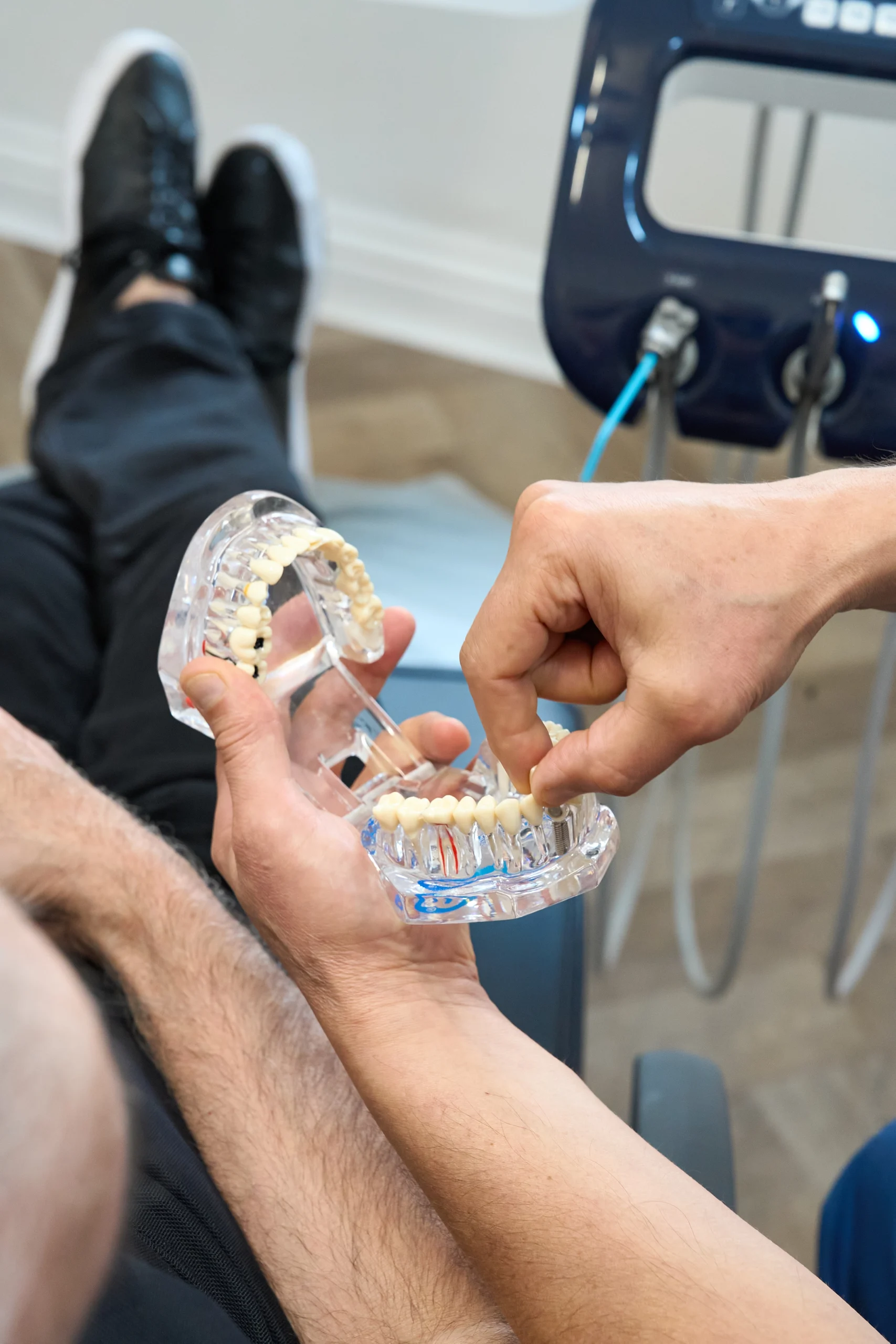 Tooth Extraction