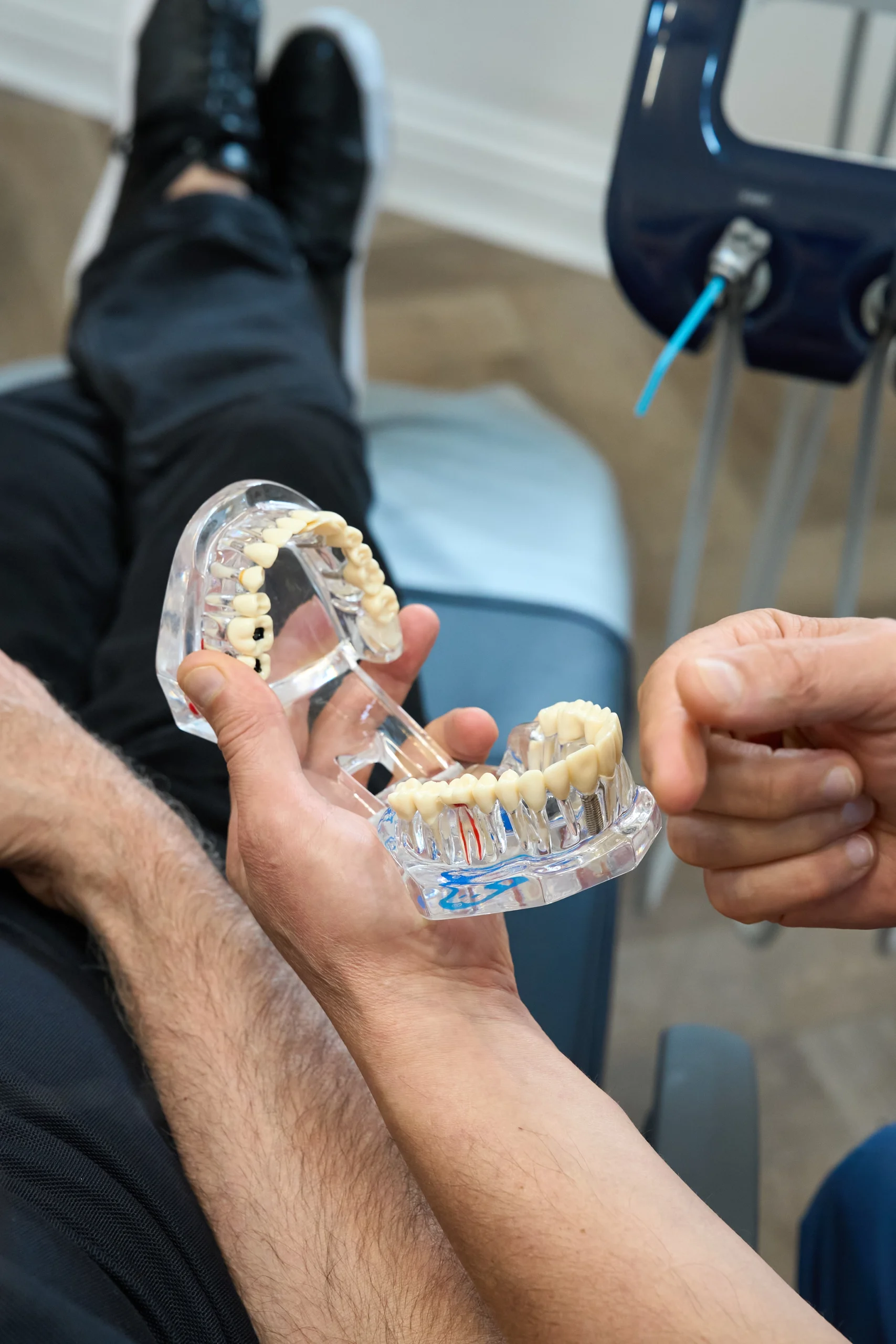 Implant placement