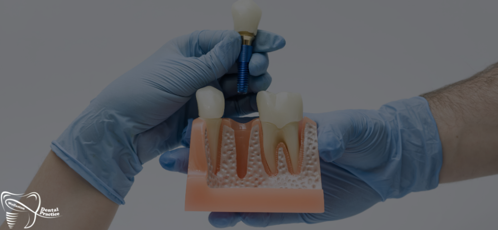 dental implants procedure - what is involved