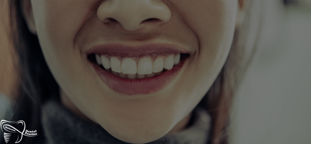gummy smile - dentist advice
